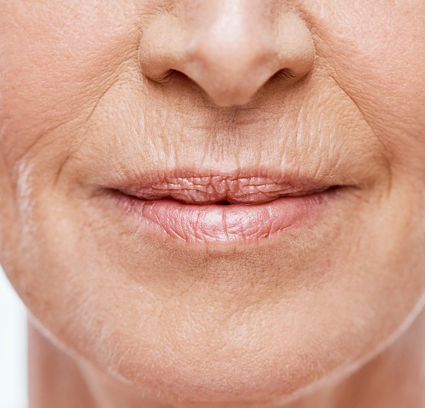 Photo of a close-up on a woman's facial wrinkles